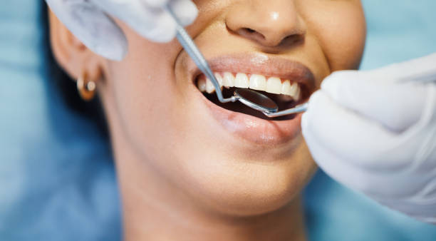 Best Walk-In Emergency Dental Services in Burlington, IA