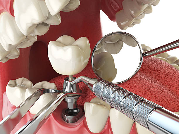 Best Weekend Emergency Dental Services in Burlington, IA